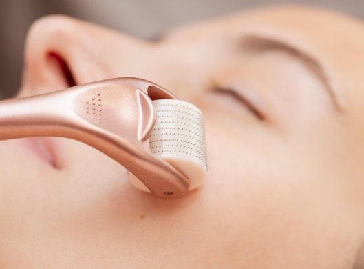 خدمة المايكرونيدلينغ - Medgel